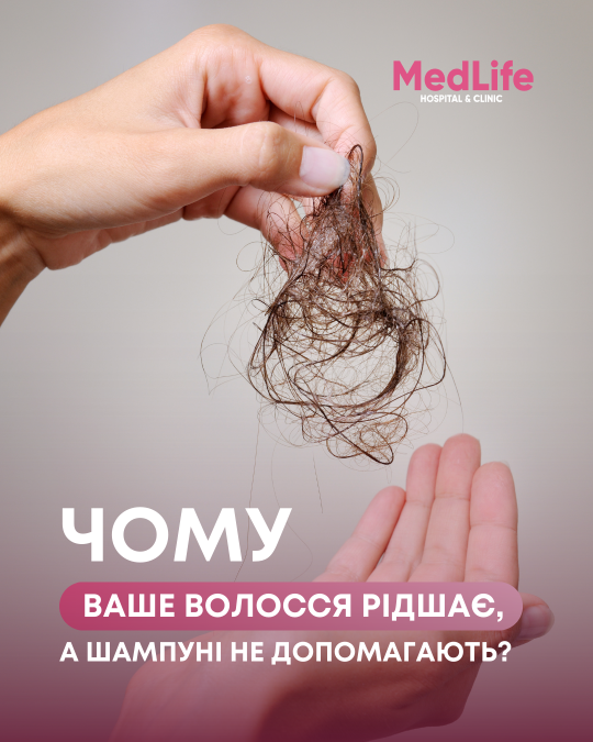Чому ваше волосся рідшає, а шампуні не допомагають?